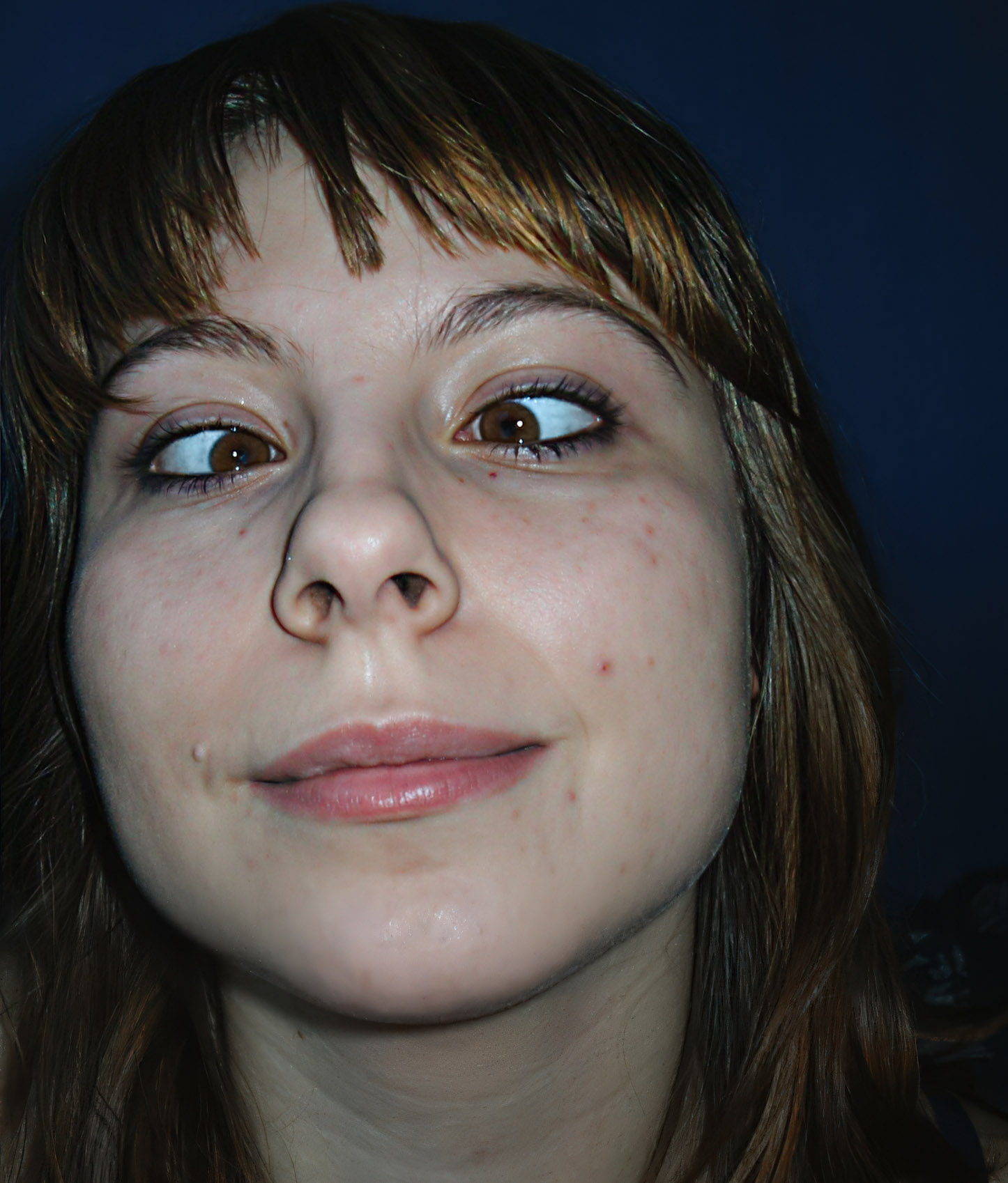 Martyna